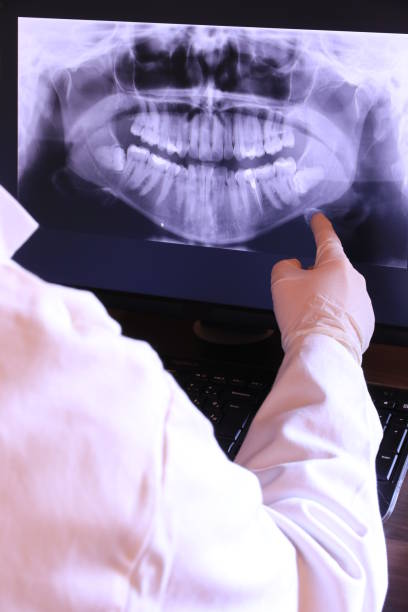 Best Broken or Cracked Tooth Emergency Dentist in Medina, TN